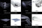 Hansø Electric Retractable Awning